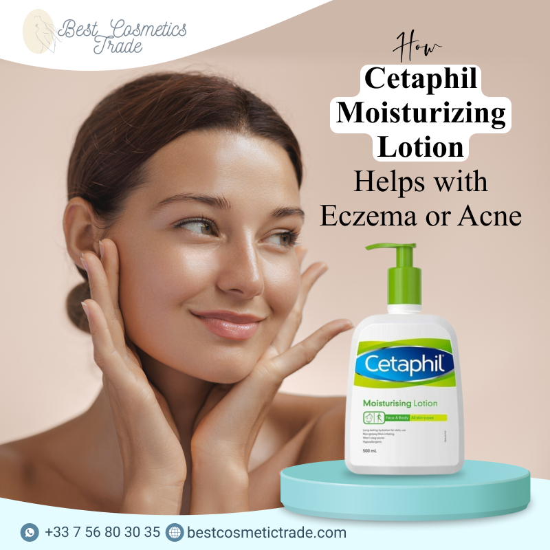 How Cetaphil Moisturizing Lotion Helps with Eczema or Acne